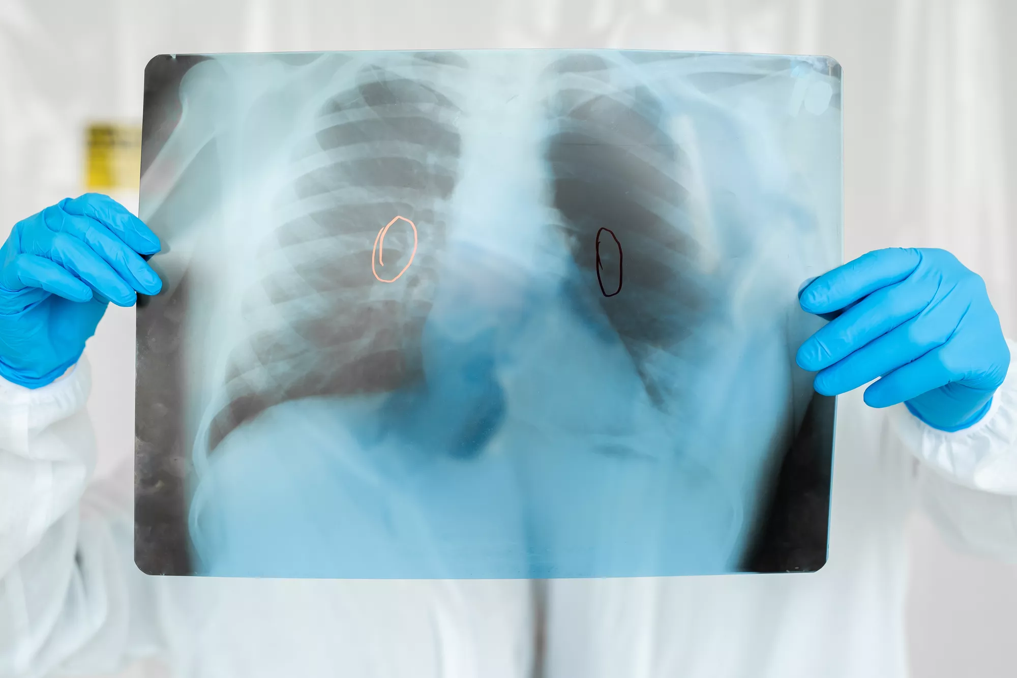 Specialty Focused Radiology