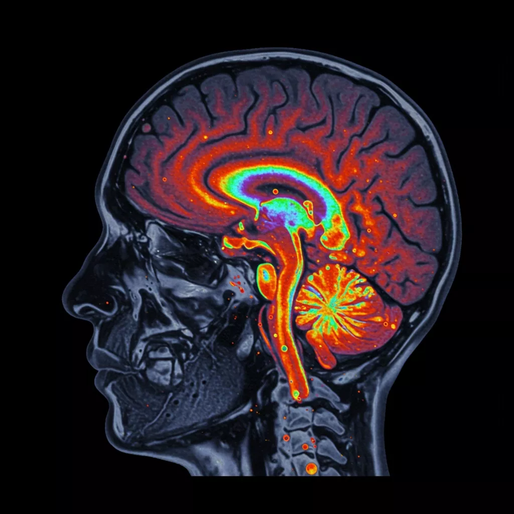 Positron Emission Tomography (PET)